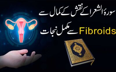 Fibroids Se Mukamal Nijat Ka Naqsh